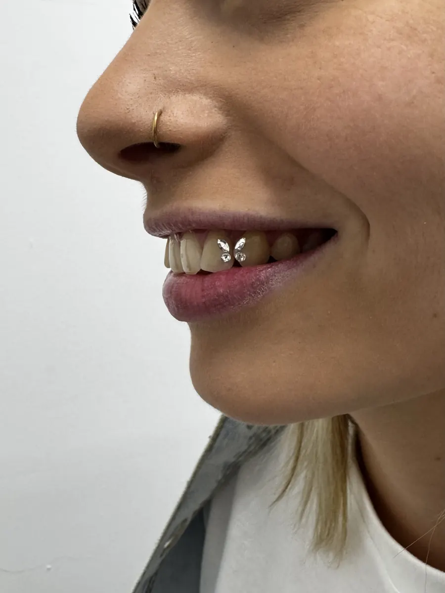 Schmetterling aus Zahnschmuck auf zwei Zähnen – Line Tattoo Heilbronn